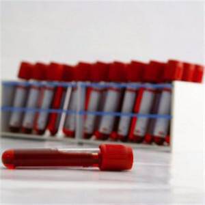 Γρήγορο τεστ αίματος για τη διάγνωση των μυκήτων, ανέπτυξαν έλληνες επιστήμονες