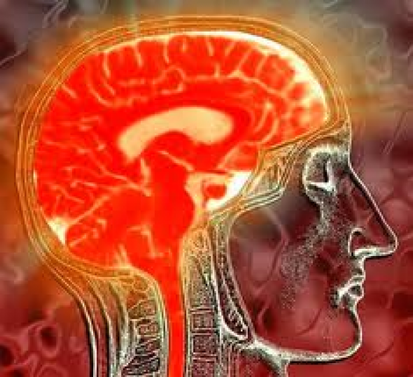 Συμπτώματα που προειδοποιούν για εμφάνιση εγκεφαλικού επεισοδίου