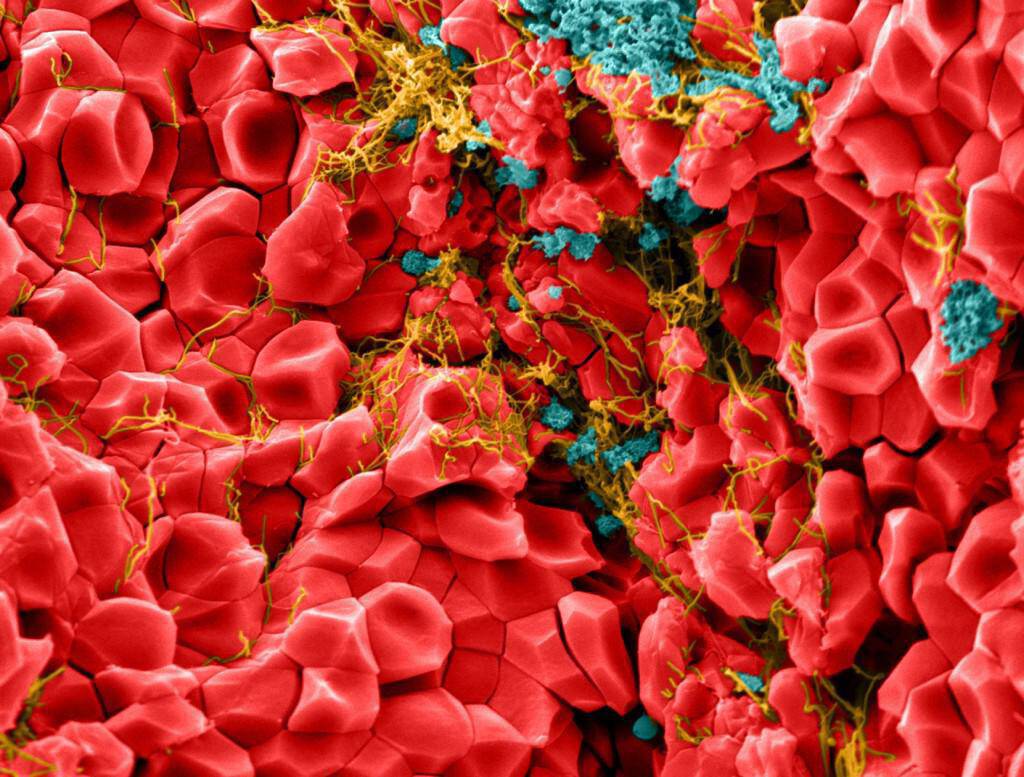 angular-red-blood-cells