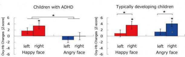The right part of the brain of typically developing children responded to both happy and angry faces. On the other hand, the brain of children with ADHD did not respond to the angry face, while it responded to the happy face.  Credit: © National Institutes of Natural Sciences