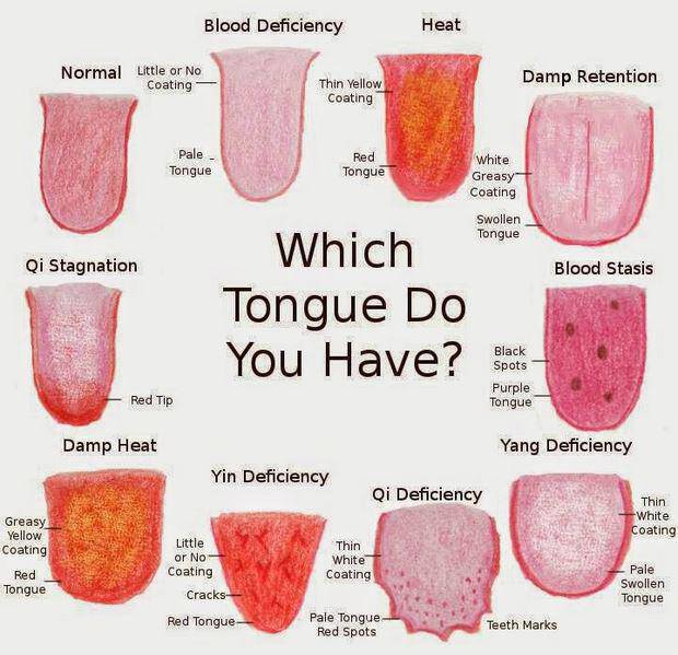 Τι δείχνει το χρώμα της γλώσσας για την υγεία σας