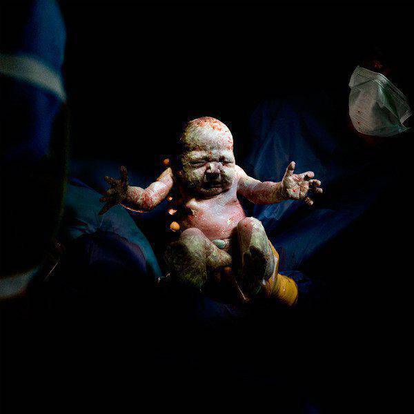 Μοναδικές φωτογραφίες μωρών, δευτερόλεπτα μετά τη γέννησή τους!(εικόνες)