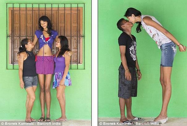 Βραζιλία: Ο έρωτας ύψος δεν κοιτά! Η απίστευτη ιστορία του πιο αταίριαστου ζευγαριού