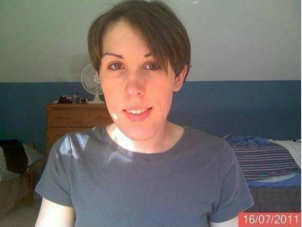 ΣΟΚΑΡΙΣΤΙΚΟ: Νεαρός έπαιρνε θηλυκές ορμόνες για 14 μήνες! ΔΕΙΤΕ πως έγινε (φωτογραφίες)