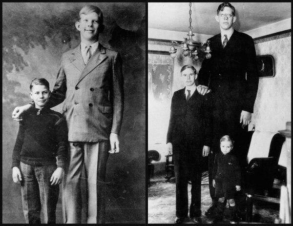 Ο ψηλότερος άντρας στον κόσμο είχε ύψος 2 μέτρα και 73 εκατοστά! Πέθανε 22 χρόνων από μόλυνση στο πόδι και το φέρετρο ζύγιζε 453 κιλά !!