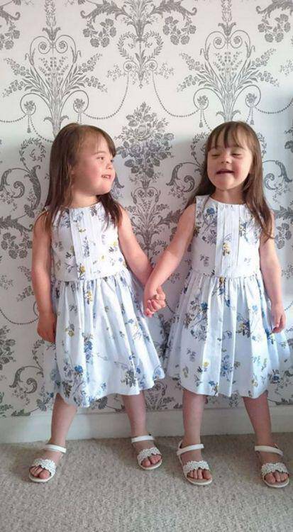 Identical-twins-born-with-Downs-syndrome