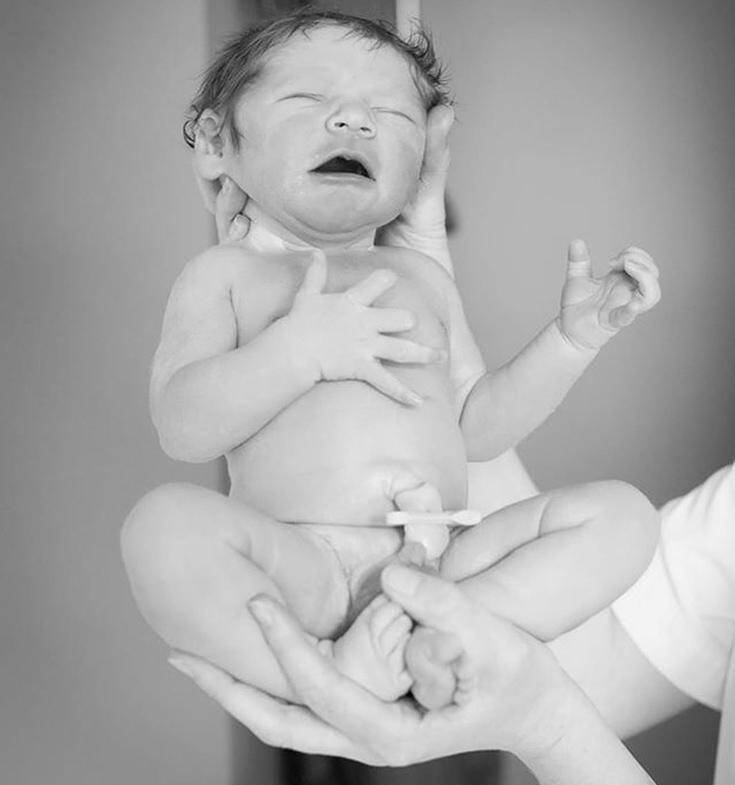 Το θαύμα της ζωής: 10 Φωτογραφίες από βρέφη λίγα δευτερόλεπτα μετά τη γέννησή τους