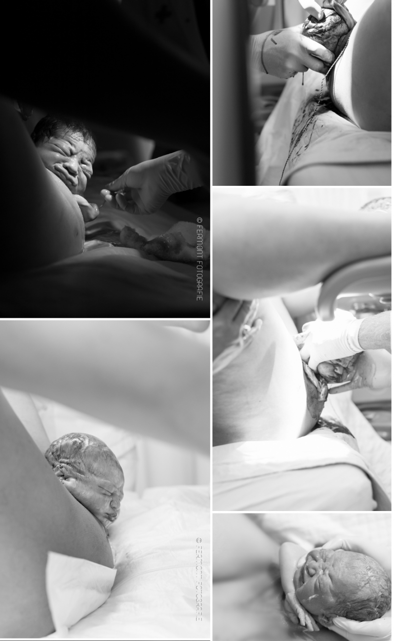 Μοναδικές φωτογραφίες τοκετού. Οι φατσούλες των μωρών όταν γεννιούνται