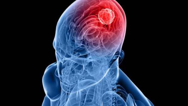 Εγκεφαλίτιδα: Αίτια, συμπτώματα και αντιμετώπιση της επικίνδυνης νόσου