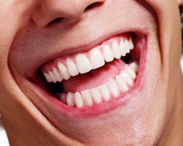 Αποχρωματισμός δοντιών: Πού οφείλεται, πώς θα τον προλάβετε