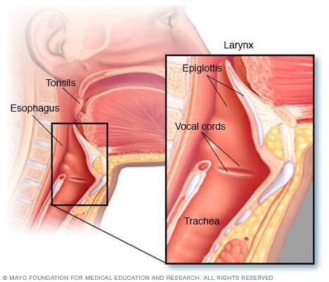 Καρκίνος στον λαιμό: Αίτια, συμπτώματα και παράγοντες κινδύνου