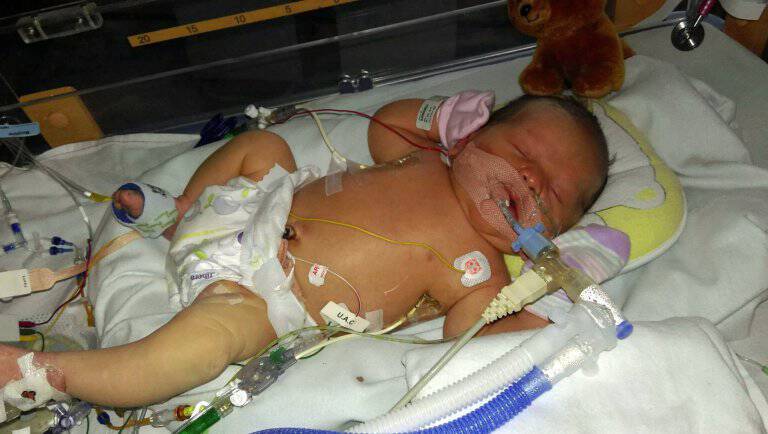 Μωρό γεννήθηκε με νερό αντι για αίμα στο κορμάκι του. Και οι γιατροί δεν έχουν ξαναδεί κάτι τέτοιο.