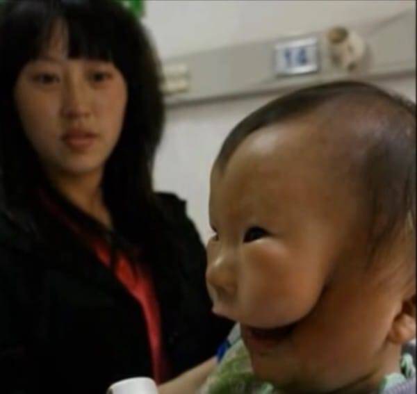 Η μάνα έβαλε τα κλάματα μόλις είδε το πρόσωπο του νεογέννητου μωρού της. Οι γιατροί δεν είχαν ξαναδεί ποτέ κάτι τέτοιο.