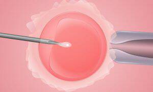 bigstock-in-vitro-fertilization-109850546