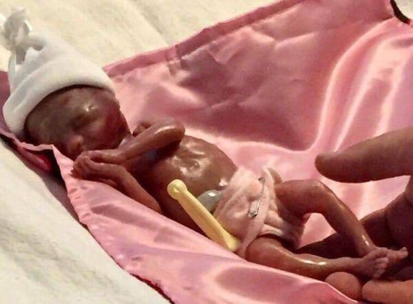 Απέβαλε το μωρό της αλλά το κράτησε 2 ώρες στην αγκαλιά της πριν φύγει απ΄τη ζωή.