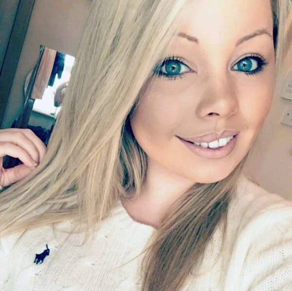 PIC FROM CATERS NEWS - (PICTURED: Amy Elsegood now.) - A beautiful woman with a birthmark covering half her face has launched a make-up vlog to share her impressive camouflage techniques. Amy Elsegood, 24, from Ripon, North Yorkshire, was diagnosed with a birthmark on her face commonly known as a port wine stain - shortly after birth. The purple coloured mark has caused Amy to be bullied and despite finally feeling comfortable in her own skin, she has decided to try and help others. After using special make-up since 11 years old to conceal her birthmark, Amy has now adopted her own techniques to make her face appear symmetrical and blemish free. Since launching her first video on Sunday (November 6) Amy has already received dozens of supportive messages. SEE CATERS COPY.
