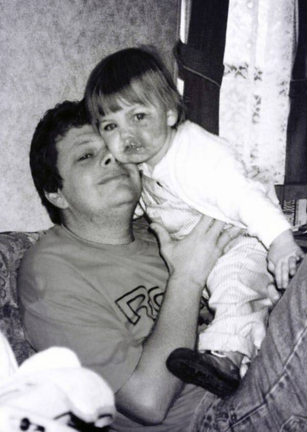 PIC FROM CATERS NEWS - (PICTURED: Amy Elsegood as a child with her dad) - A beautiful woman with a birthmark covering half her face has launched a make-up vlog to share her impressive camouflage techniques. Amy Elsegood, 24, from Ripon, North Yorkshire, was diagnosed with a birthmark on her face commonly known as a port wine stain - shortly after birth. The purple coloured mark has caused Amy to be bullied and despite finally feeling comfortable in her own skin, she has decided to try and help others. After using special make-up since 11 years old to conceal her birthmark, Amy has now adopted her own techniques to make her face appear symmetrical and blemish free. Since launching her first video on Sunday (November 6) Amy has already received dozens of supportive messages. SEE CATERS COPY.