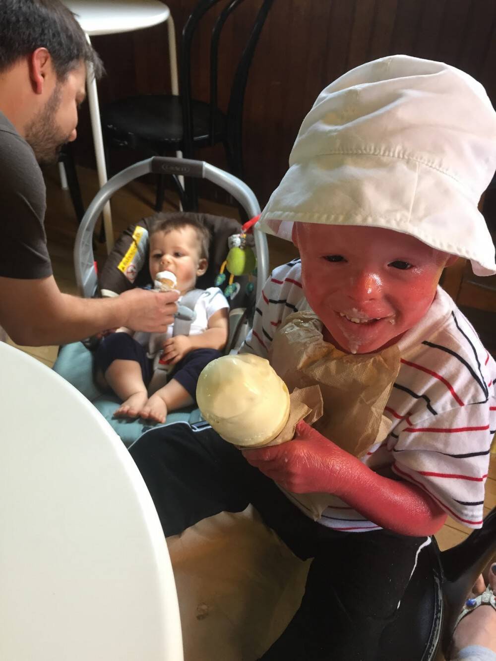 Μωρό γεννιέται με το κορμάκι του καλυμμένο με παχιά λευκά «λέπια». 5 χρόνια μετά, οι γιατροί δεν έχουν ξαναδει πρόσωπο σαν το δικό του.