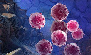 bigstock-Cancer-Cell-129643601