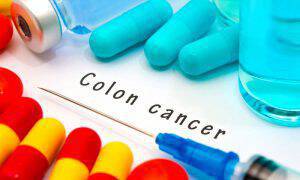 bigstock-Colon-Cancer-109968236