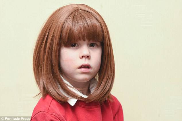 Δάσκαλοι ανάγκασαν 5χρονο κορίτσι με αλωπεκία να βγάλει την περούκα του κατά τη διάρκεια του μαθήματος