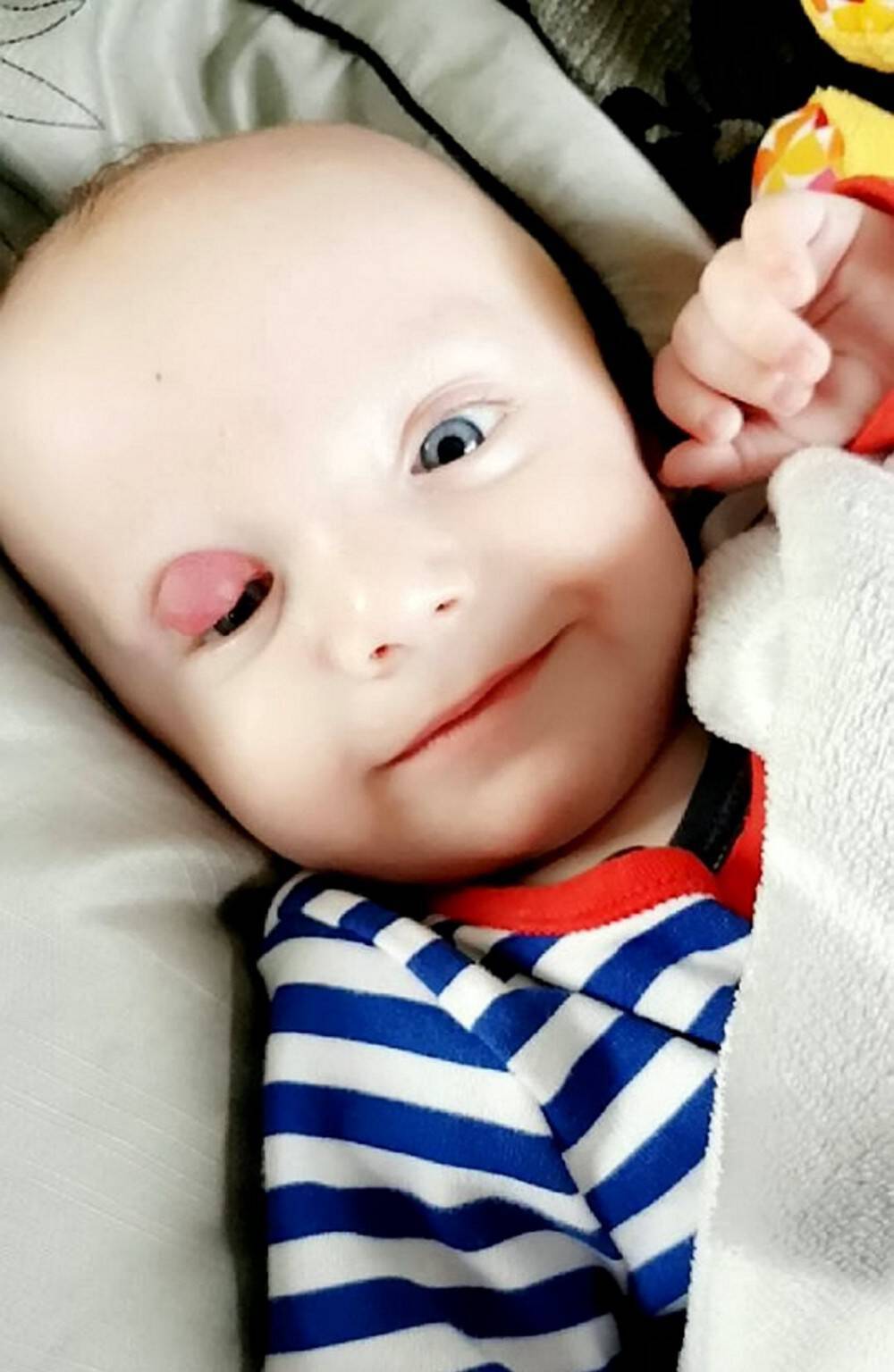 Το πρόωρο μωρό τους γεννήθηκε με έναν μεγάλο όγκο στο μάτι. Όταν οι γιατροί τους απογοήτευσαν, δεν έχασαν την πίστη τους και πέτυχαν το ανέλπιστο!