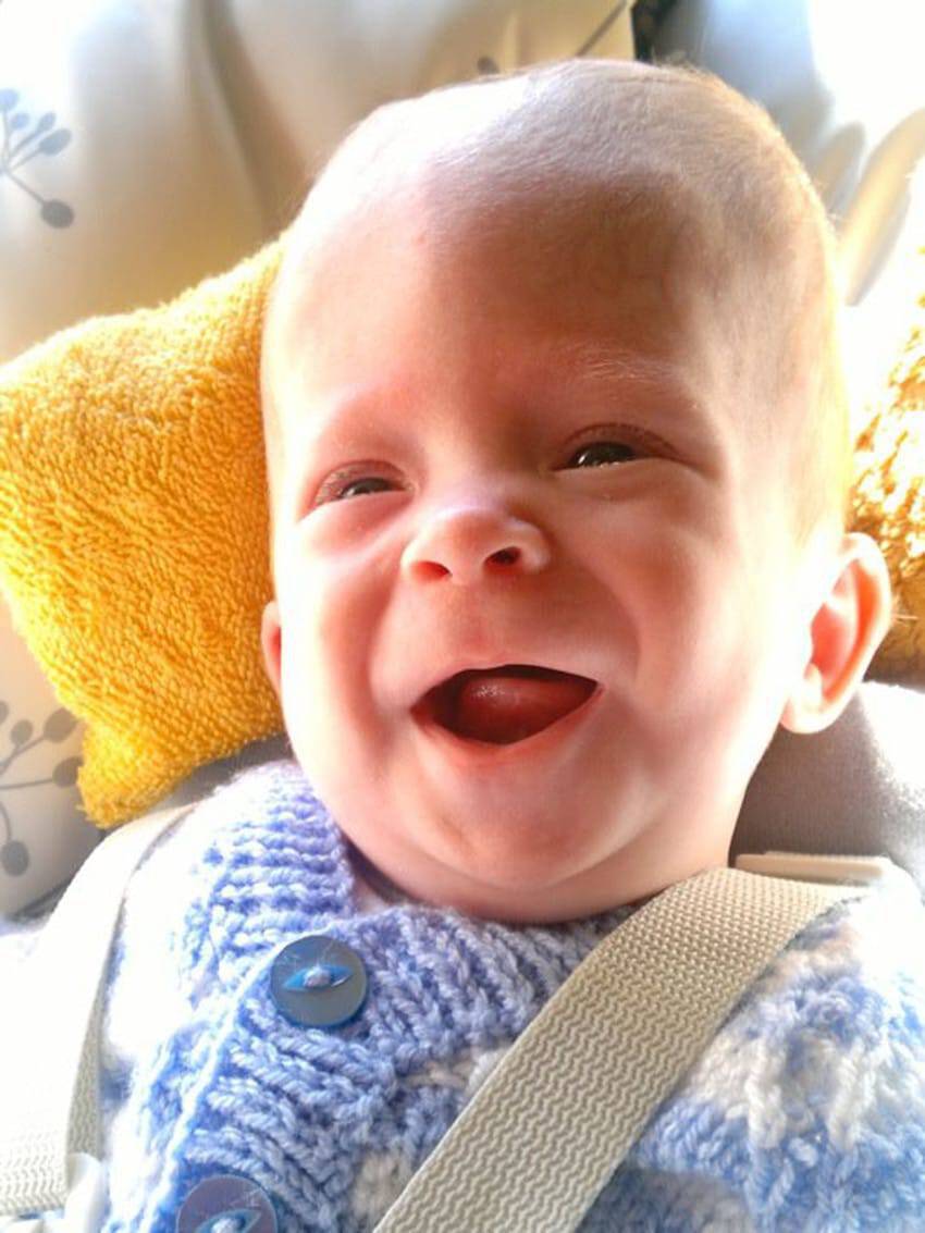 Μωρό που γεννήθηκε 4 χρόνια πριν «χωρίς εγκέφαλο» εκπλήσσει σήμερα τους γιατρούς όταν το μυαλό του αρχίζει να μεγαλώνει
