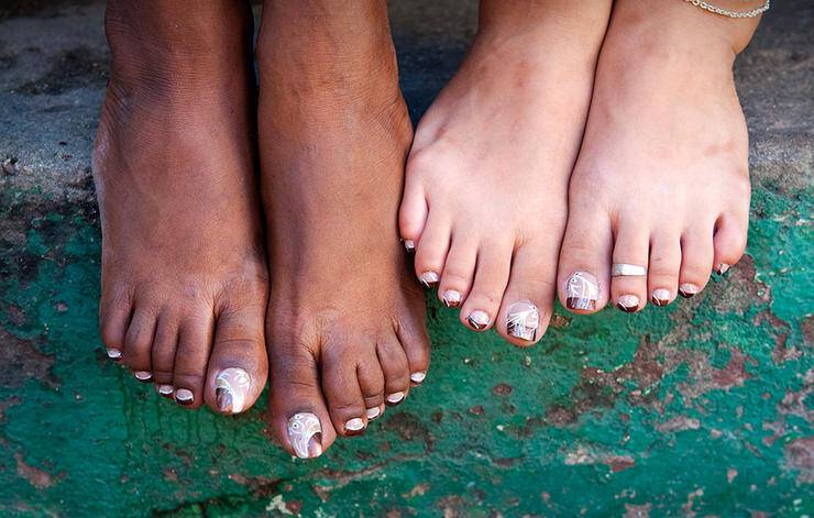 Νύχια ποδιών που μαυρίζουν: Δείτε πότε κινδυνεύετε