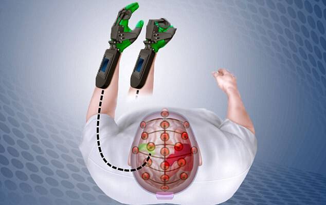 Εγκεφαλικό: Μοναδική συσκευή “αντιστρέφει” την μερική παράλυση μετά από σοβαρό επεισόδιο [vid, pic]