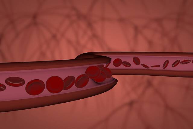 Τα αυξημένα αιμοπετάλια ισχυρή ένδειξη για καρκίνο
