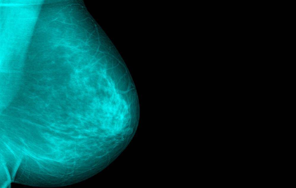 Διαβήτης & καρκίνος μαστού: Ο ρόλος της ασπιρίνης