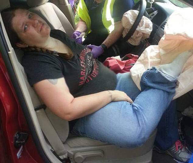 Γιατί να μην βάζετε ΠΟΤΕ τα πόδια στο ταμπλό του αυτοκινήτου – Δείτε τι της έκανε ο αερόσακος σε ελαφρύ τρακάρισμα [vid, pics]
