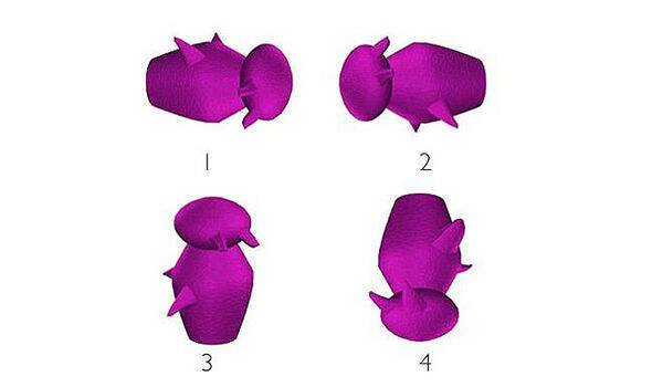 Τεστ για Αλτσχάιμερ: Βλέπετε ποιο σχήμα διαφέρει από τα άλλα; Τι λένε επιστήμονες! [pics]
