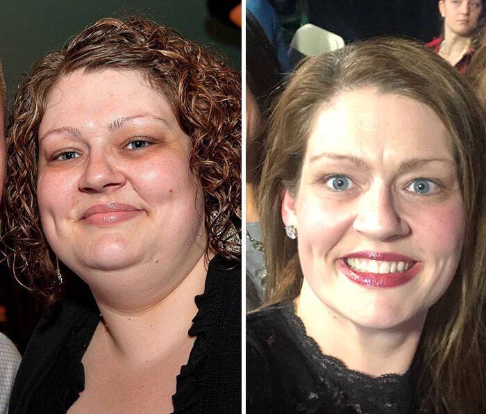 Αυτή η γυναίκα έχασε 70 κιλά σε 2 χρόνια και μοιράζεται τις συμβουλές του διατροφολόγου της