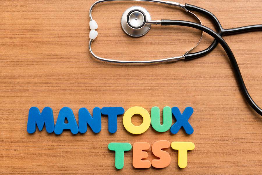 test mantoux