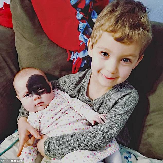The nickname came about when her two brothers (Devin, four, pictured) asked their mother what mark was covering their sister's face and Lacey said it made her a superhero