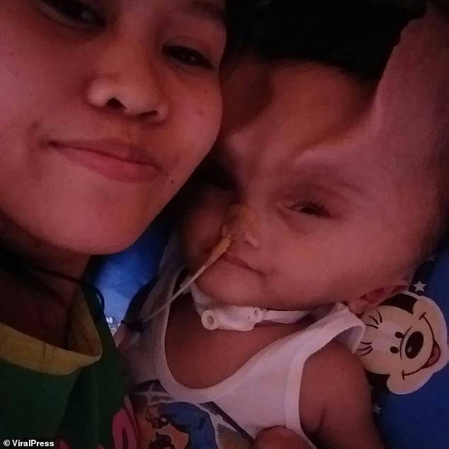 Miss Gatarin, 21 (pictured with her son) says Clyne needs another operation to reconstruct his skull but she already sold 'almost everything we own' to afford the first surgery, and is worried her son is not strong enough for more procedures