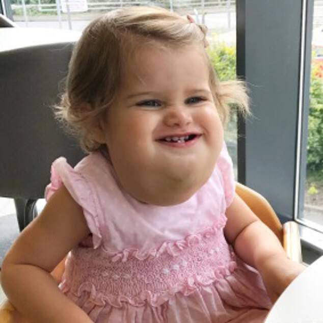 Eden Sue Jones was born with aÂ cystic hygroma but has grown a happy two-year-old girl