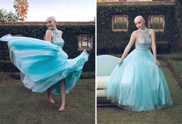 17χρονη με καρκίνο δίνει μαθήματα ζωής και φωτογραφίζεται χωρίς μαλλιά - Εικόνα 5