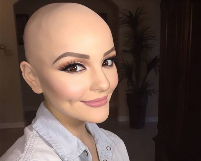 17χρονη με καρκίνο δίνει μαθήματα ζωής και φωτογραφίζεται χωρίς μαλλιά - Εικόνα 9