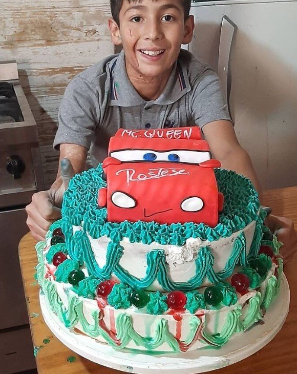 10χρονος με εγκαύματα φτιάχνει τούρτες και γλυκά 